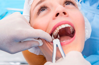 Extração de Dentes